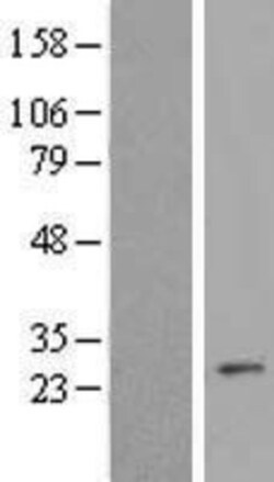 Novus Biologicals&trade;&nbsp;MALSU1 Overexpression Lysate