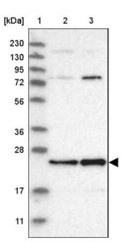 MALSU1 Antibody, Novus Biologicals 0.1mL; Unlabeled:Antibodies, Polyclonal