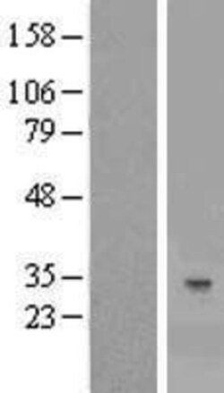 Novus Biologicals&trade;&nbsp;YAE1 Overexpression Lysate