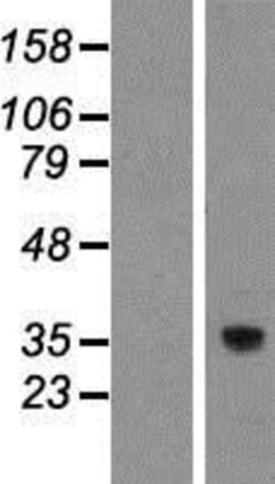 Novus Biologicals&trade;&nbsp;TMEM248 Overexpression Lysate