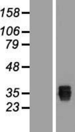 Novus Biologicals&trade;&nbsp;SSMEM1 Overexpression Lysate