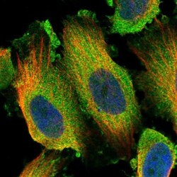 FAM221A Antibody, Novus Biologicals:Antibodies:Primary Antibodies