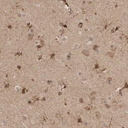 FAM221A Antibody, Novus Biologicals:Antibodies:Primary Antibodies