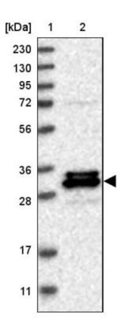 FAM221A Antibody, Novus Biologicals:Antibodies:Primary Antibodies