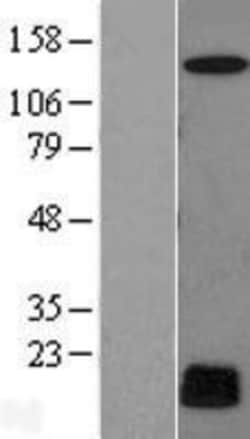 Novus Biologicals&trade;&nbsp;CYREN Overexpression Lysate