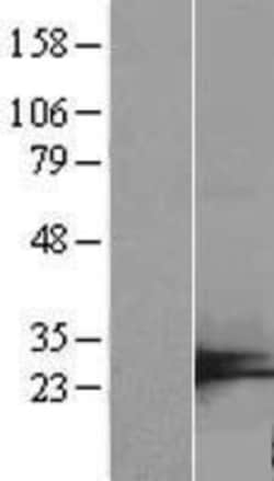 Novus Biologicals C7orf50 Overexpression Lysate 0.1 mg | Buy Online | Novus Biologicals&trade; | Fisher Scientific