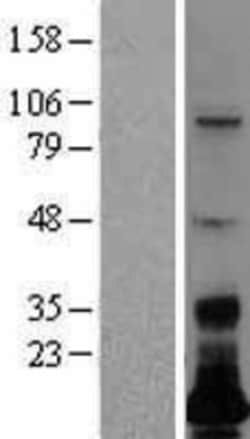 Novus Biologicals&trade;&nbsp;LSMEM1 Overexpression Lysate