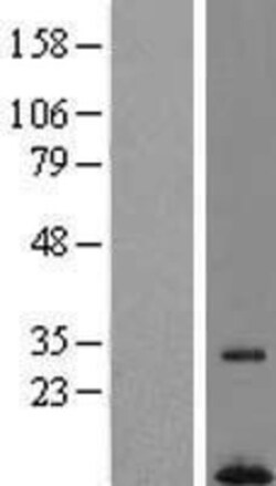 Novus Biologicals&trade;&nbsp;HSPC268 Overexpression Lysate