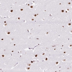 LUC7L2 Antibody, Novus Biologicals 0.1mL; Unlabeled:Antibodies, Polyclonal