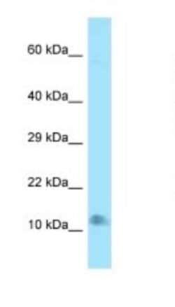 LAMTOR4 Antibody, Novus Biologicals 20&mu;L; Unlabeled:Antibodies, Polyclonal