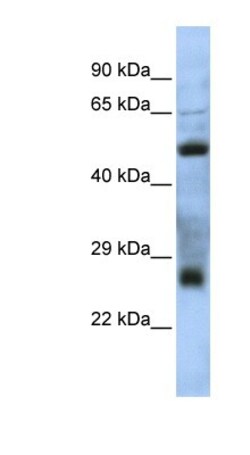 TEX47 Antibody, Novus Biologicals 100 &mu;L | Buy Online | Novus Biologicals | Fisher Scientific