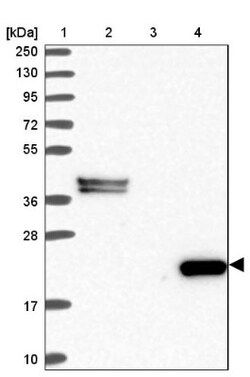 C8G Antibody, Novus Biologicals:Antibodies:Primary Antibodies