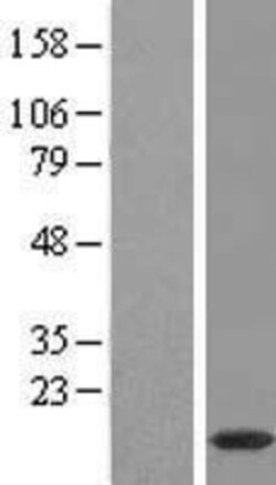 Novus Biologicals&trade;&nbsp;PPDPFL Overexpression Lysate