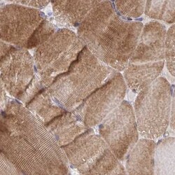 PPDPFL Antibody, Novus Biologicals:Antibodies:Primary Antibodies