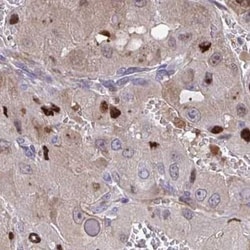 PPDPFL Antibody, Novus Biologicals:Antibodies:Primary Antibodies