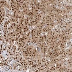 C8orf33 Antibody, Novus Biologicals 0.1mL; Unlabeled:Antibodies, Polyclonal