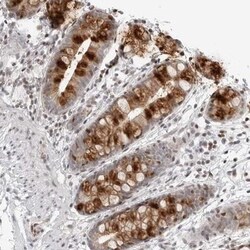 anti-C8orf33, Polyclonal, Novus Biologicals 0.1mL; Unlabeled:Antibodies,