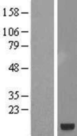 Novus Biologicals™ SMIM19 Overexpression Lysate