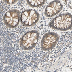 SMIM19 Antibody, Novus Biologicals:Antibodies:Primary Antibodies