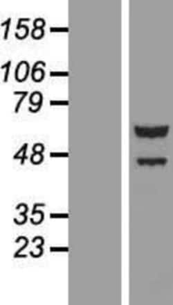 Novus Biologicals&trade;&nbsp;TTI2 Overexpression Lysate