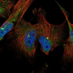 TTI2 Antibody, Novus Biologicals 0.1mL; Unlabeled:Antibodies, Polyclonal