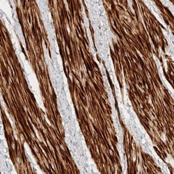 TTI2 Antibody, Novus Biologicals 0.1mL; Unlabeled:Antibodies, Polyclonal
