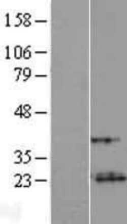 Novus Biologicals&trade;&nbsp;VXN Overexpression Lysate