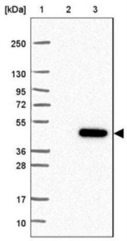 C8orf48 Antibody, Novus Biologicals 0.1mL; Unlabeled:Antibodies, Polyclonal