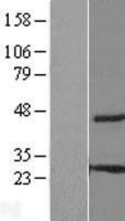Novus Biologicals™ THEM6 Overexpression Lysate