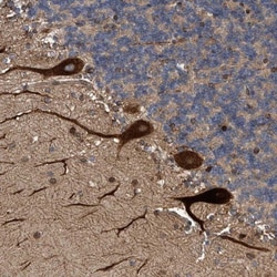 THEM6 Antibody, Novus Biologicals 25 &mu;L | Buy Online | Novus Biologicals | Fisher Scientific