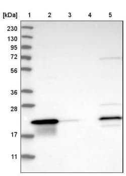 THEM6 Antibody, Novus Biologicals 25 &mu;L | Buy Online | Novus Biologicals | Fisher Scientific