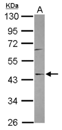 SPOUT1 Antibody, Novus Biologicals 0.1mL; Unlabeled:Antibodies, Polyclonal