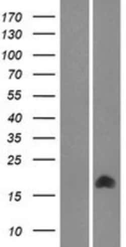 Novus Biologicals&trade;&nbsp;TMEM261 Overexpression Lysate