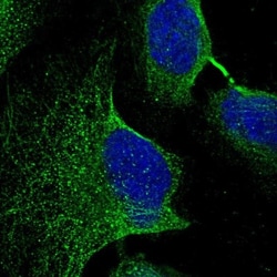 FAM221B Antibody, Novus Biologicals 0.1mL; Unlabeled:Antibodies, Polyclonal