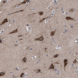 C9orf135 Antibody, Novus Biologicals:Antibodies:Primary Antibodies