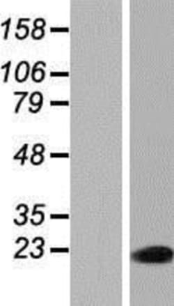 Novus Biologicals™ PAXX Overexpression Lysate