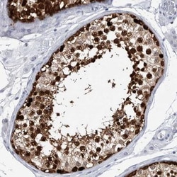 LURAP1L Antibody, Novus Biologicals 25 &mu;L; Unlabeled:Antibodies, Polyclonal