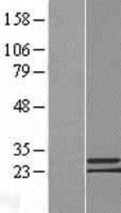 Novus Biologicals&trade;&nbsp;C9orf152 Overexpression Lysate