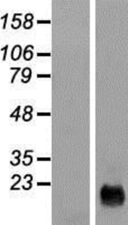 Novus Biologicals&trade;&nbsp;Cysteine Rich Tail 1 Overexpression Lysate