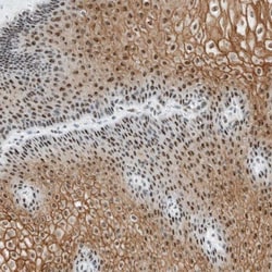 Cysteine Rich Tail 1 Antibody, Novus Biologicals 0.1mL; Unlabeled:Antibodies,