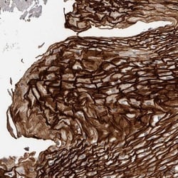 Cysteine Rich Tail 1 Antibody, Novus Biologicals 25 &mu;L; Unlabeled:Antibodies,