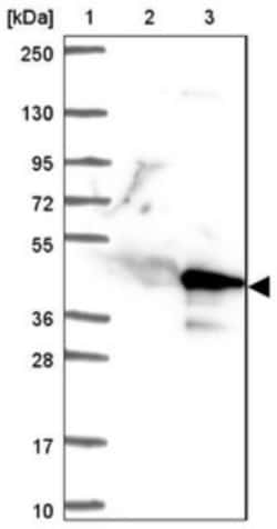 CFAP77 Antibody, Novus Biologicals 25 &mu;L | Buy Online | Novus Biologicals | Fisher Scientific