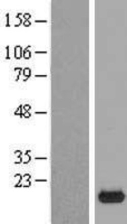 Novus Biologicals™ RPP25L Overexpression Lysate