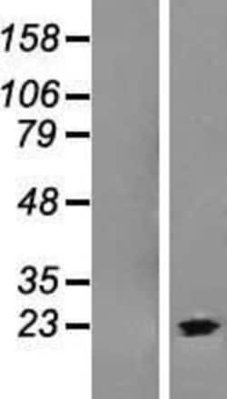 Novus Biologicals&trade;&nbsp;C9orf37 Overexpression Lysate
