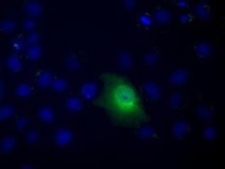 CARNMT1 Antibody (OTI4B7), Novus Biologicals 0.1mL; Unlabeled:Antibodies,