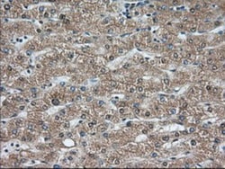 CARNMT1 Antibody (OTI4B7), Novus Biologicals 0.1mL; Unlabeled:Antibodies,