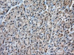 CARNMT1 Antibody (OTI4B7), Novus Biologicals 0.1mL; Unlabeled:Antibodies,