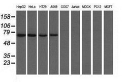 CARNMT1 Antibody (OTI4B7), Novus Biologicals 0.1mL; Unlabeled:Antibodies,