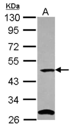 C9orf43 Antibody, Novus Biologicals 0.1mL; Unlabeled:Antibodies, Polyclonal
