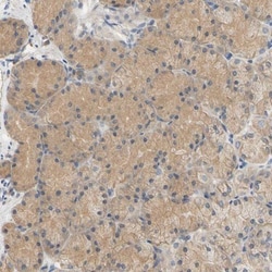 PLGRKT Antibody, Novus Biologicals 0.1mL; Unlabeled:Antibodies, Polyclonal